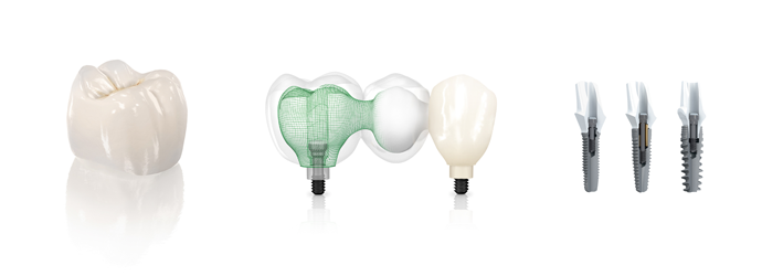 Crowns, Bridges, and Implants